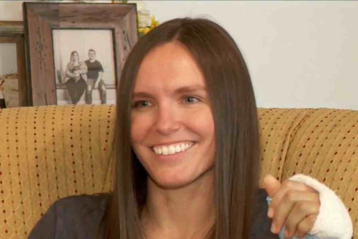 la donna aggredita da un alligatore si mostra sorridente